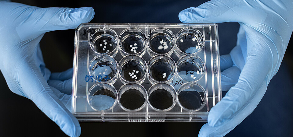 30- and 60-day-old brain organoids in a Petri dish